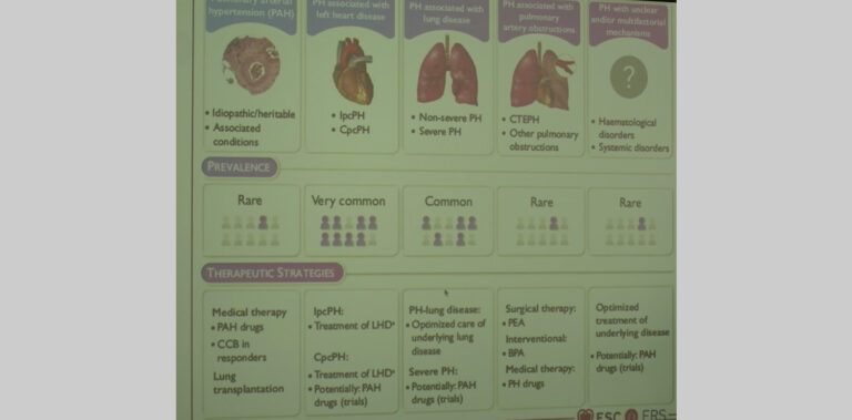 CTEPH - what is it and how to treat it